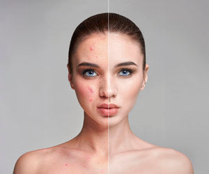 Vacu Clear a 248 LEU