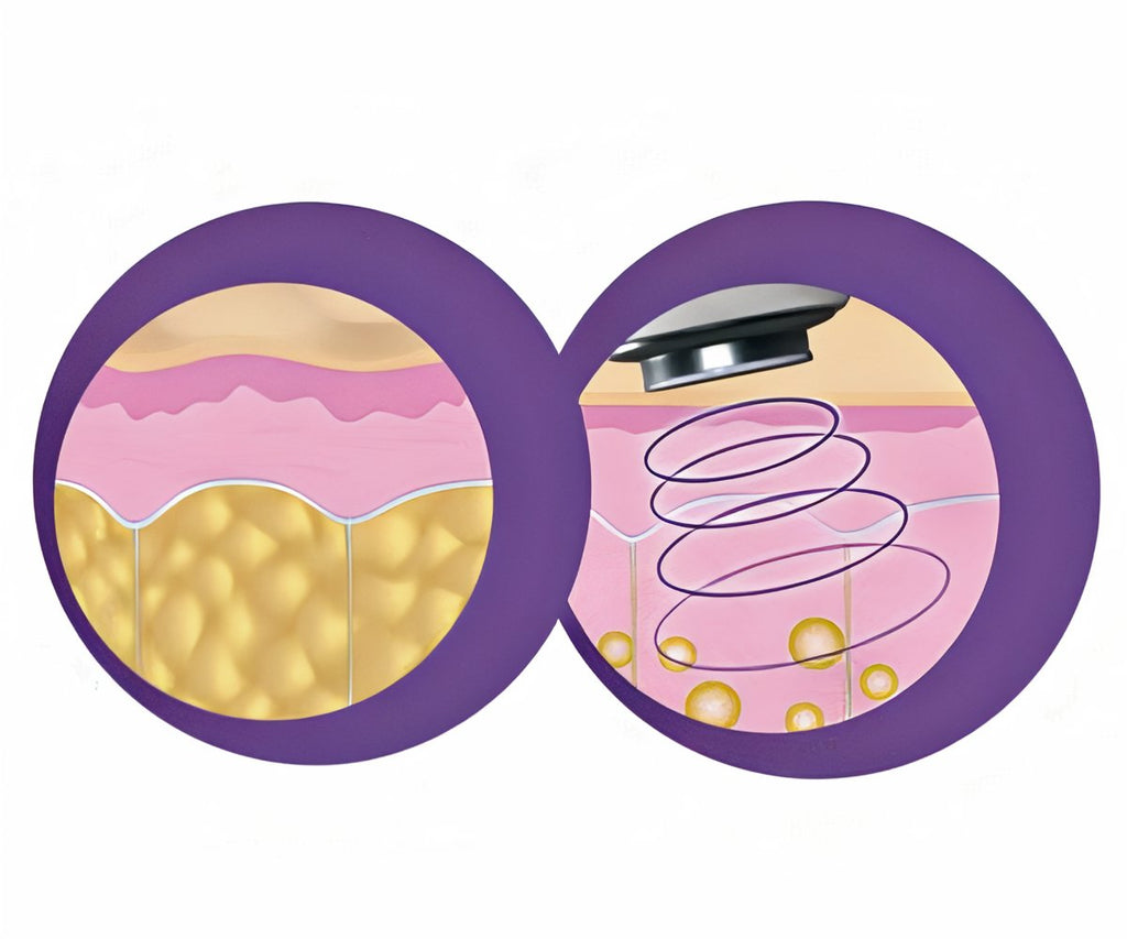 Contour Sonic Pro a 99,99€